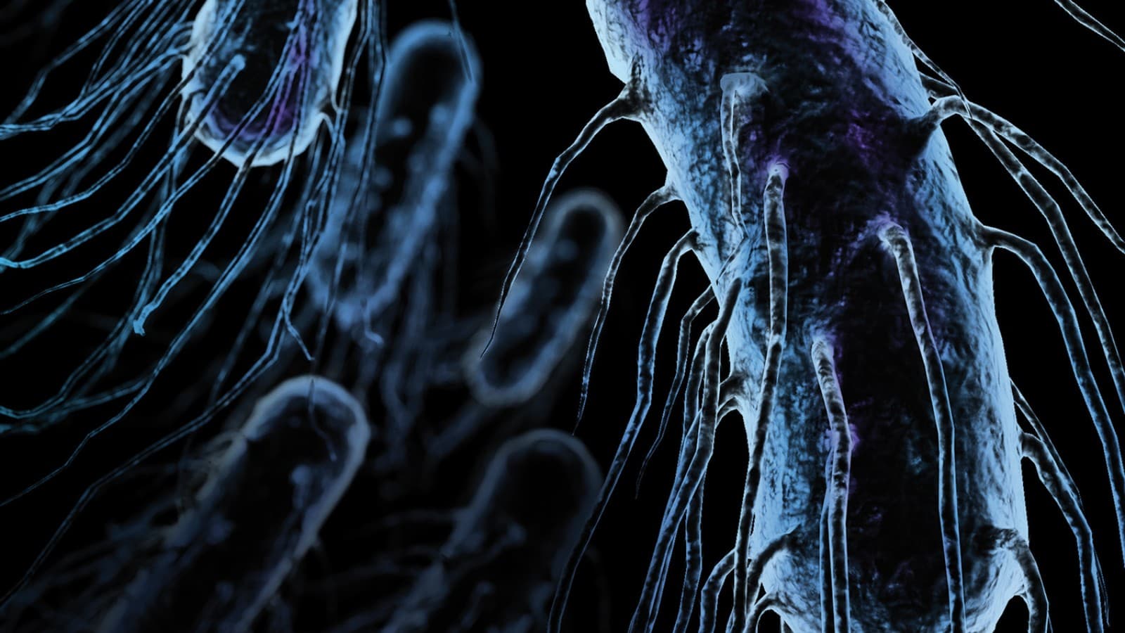 Legionella Legionella